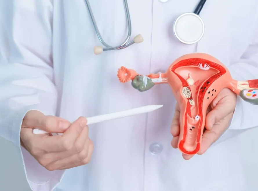 Infographic on PCOS: key symptoms, causes, and effective treatments for managing the condition and improving overall health.