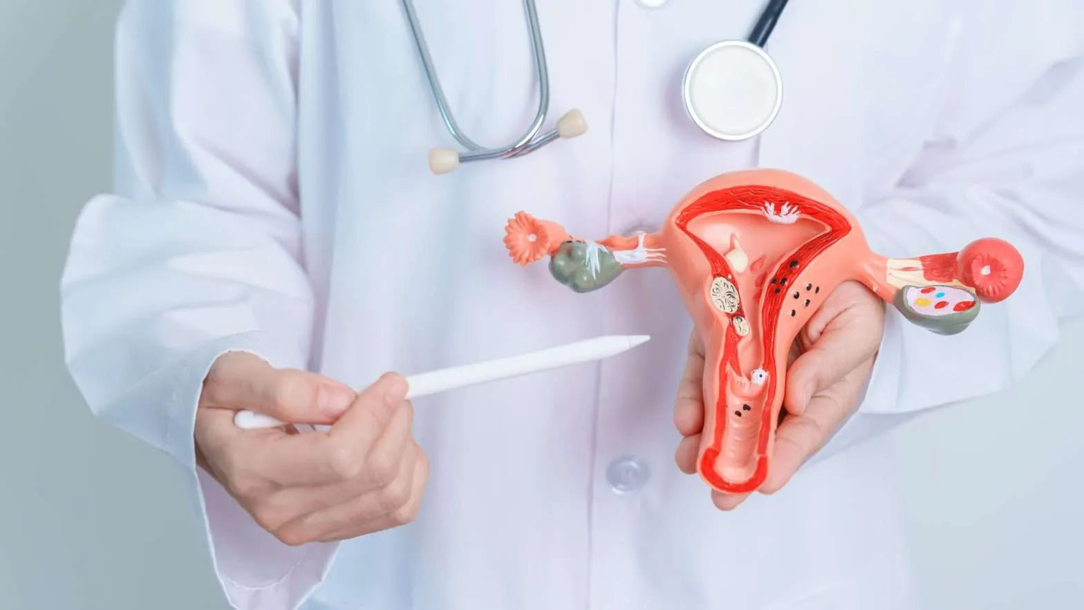 Infographic on PCOS: key symptoms, causes, and effective treatments for managing the condition and improving overall health.