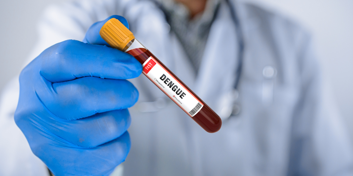 Dengue test at SRG Hospital Jaipur